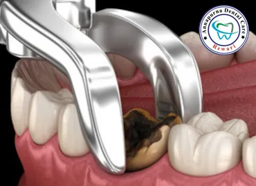 Wisdom Tooth Extractions & Oral Surgery