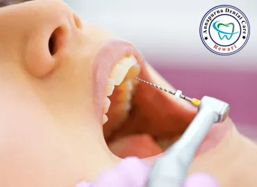 Root Canal Treatment (Microscopic RCT)