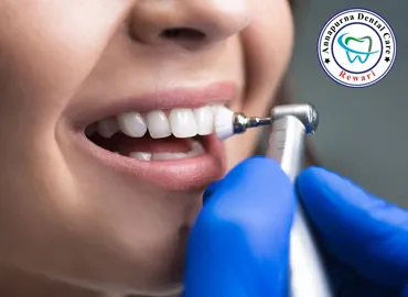 Teeth Cleaning & Laser Whitening